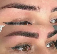 ۲۰٪ تخفیف برای فیبروز، میکروبلیدینگ و قاب و سایه 👁️