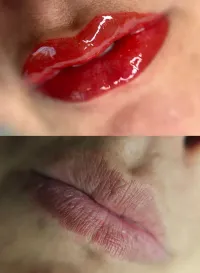 ۱۵٪ تخفیف ویژه شیدینگ لب بدون درد✨