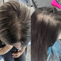 اسکراب اسکالپ (پاکسازی کف سر یا هد اسپا) با ۴۰٪ تخفیف ت
